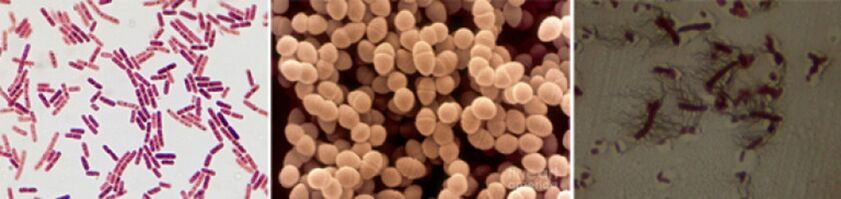 Az Escherichia coli, a széklet enterococcus és a proteus a krónikus baktériumok prosztatitisz fő okozati ágensei